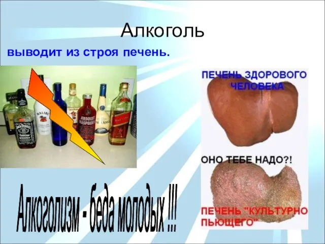 Алкоголь выводит из строя печень. Алкоголизм - беда молодых !!!