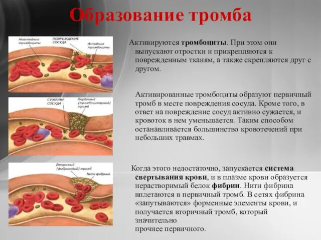 Образование тромба Активируются тромбоциты. При этом они выпускают отростки и прикрепляются