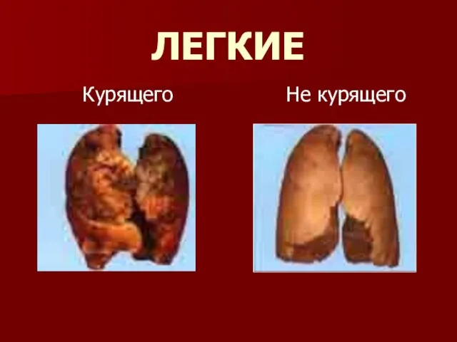 ЛЕГКИЕ Курящего Не курящего