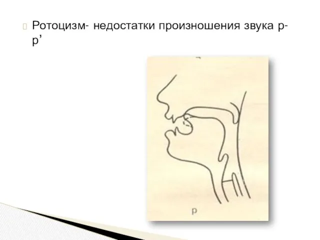 Ротоцизм- недостатки произношения звука р- р’