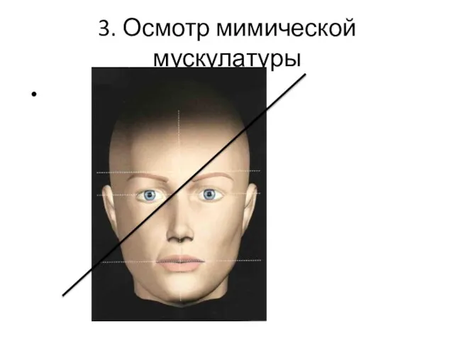 3. Осмотр мимической мускулатуры