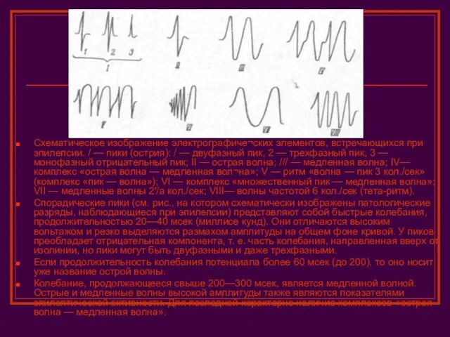 Схематическое изображение электрографиче¬ских элементов, встречающихся при эпилепсии. / — пики (острия):