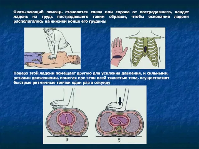 Оказывающий помощь становится слева или справа от пострадавшего, кладет ладонь на