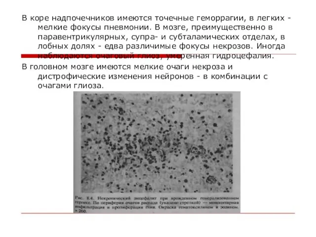 В коре надпочечников имеются точечные геморрагии, в легких - мелкие фокусы