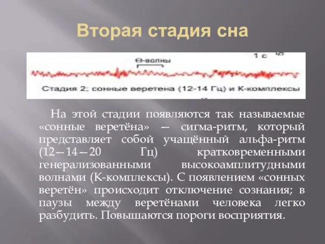 Вторая стадия сна На этой стадии появляются так называемые «сонные веретёна»