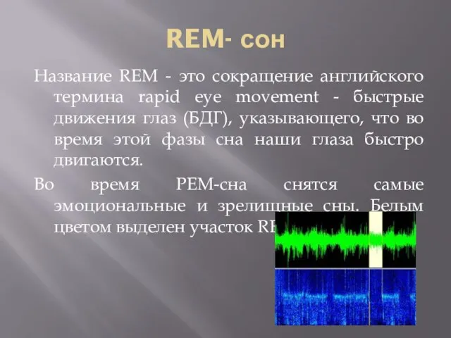 REM- сон Название REM - это сокращение английского термина rapid eye