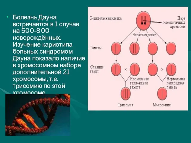 Болезнь Дауна встречается в 1 случае на 500-800 новорождённых. Изучение кариотипа