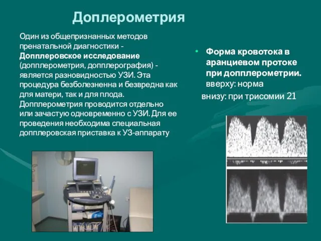 Форма кровотока в аранциевом протоке при допплерометрии. вверху: норма внизу: при