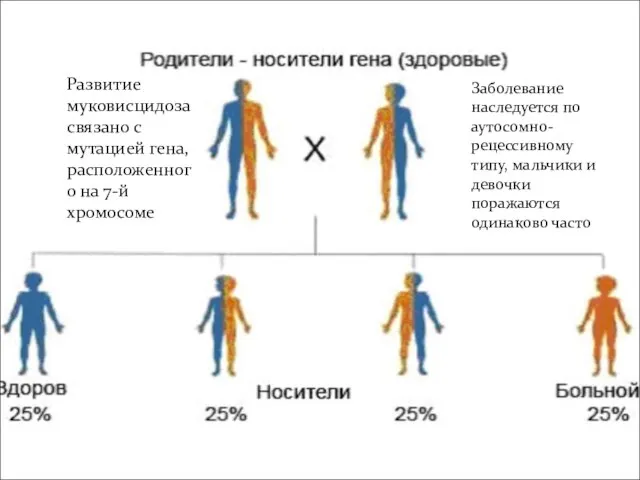 Развитие муковисцидоза связано с мутацией гена, расположенного на 7-й хромосоме Заболевание