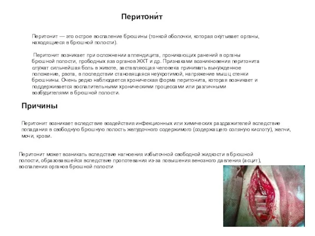 Перитонит может возникать вследствие нагноения избыточной свободной жидкости в брюшной полости,