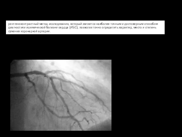 рентгеноконтрастный метод исследования, который является наиболее точным и достоверным способом диагностики