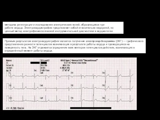 методика регистрации и исследования электрических полей, образующихся при работе сердца. Электрокардиография