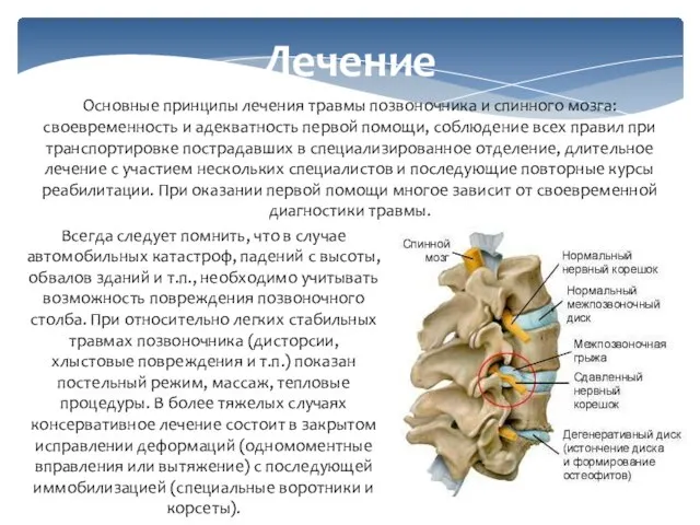 Лечение Основные принципы лечения травмы позвоночника и спинного мозга: своевременность и