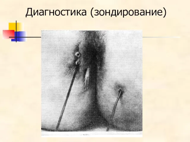 Диагностика (зондирование)