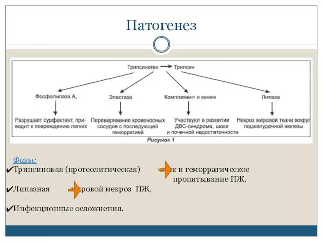 Патогенез Фазы: Трипсиновая (протеолитическая) отек и геморрагическое пропитывание ПЖ. Липазная жировой некроз ПЖ. Инфекционные осложнения.