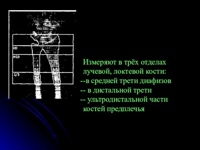 Измеряют в трёх отделах лучевой, локтевой кости: -в средней трети диафизов