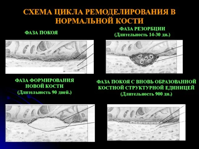 СХЕМА ЦИКЛА РЕМОДЕЛИРОВАНИЯ В НОРМАЛЬНОЙ КОСТИ ФАЗА ПОКОЯ ФАЗА РЕЗОРБЦИИ (Длительность