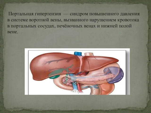 Портальная гипертензия — синдром повышенного давления в системе воротной вены, вызванного