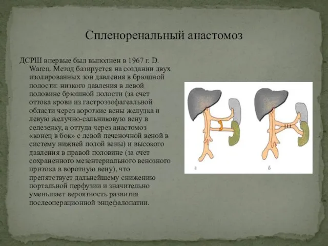 Спленоренальный анастомоз ДСРШ впервые был выполнен в 1967 г. D. Waren.