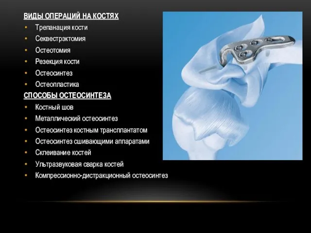 ВИДЫ ОПЕРАЦИЙ НА КОСТЯХ Трепанация кости Секвестрэктомия Остеотомия Резекция кости Остеосинтез