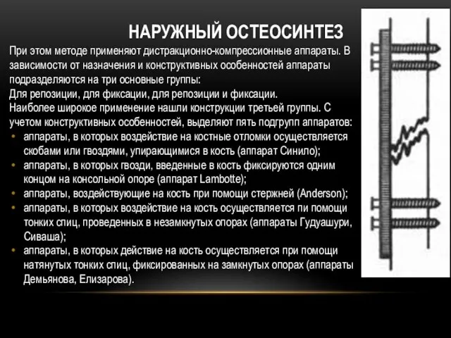 Наружный остеосинтез При этом методе применяют дистракционно-компрессионные аппараты. В зависимости от