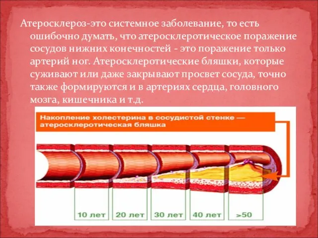 Атеросклероз-это системное заболевание, то есть ошибочно думать, что атеросклеротическое поражение сосудов