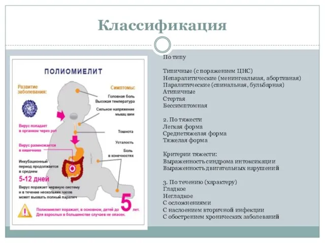 Классификация По типу Типичные (с поражением ЦНС) Непаралитические (менингеальная, абортивная) Паралитические