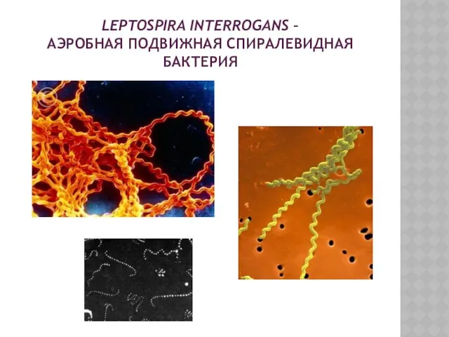 Leptospira interrogans – аэробная подвижная спиралевидная бактерия