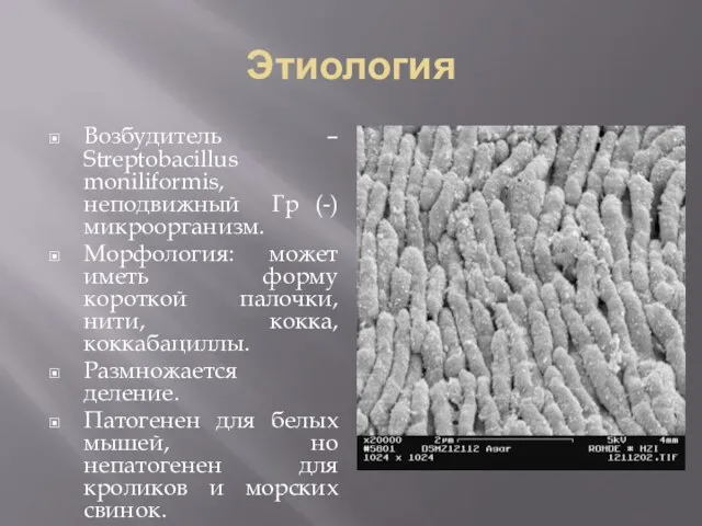 Этиология Возбудитель – Streptobacillus moniliformis, неподвижный Гр (-) микроорганизм. Морфология: может