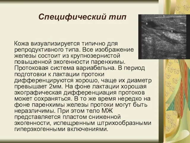 Специфический тип Кожа визуализируется типично для репродуктивного типа. Все изображение железы