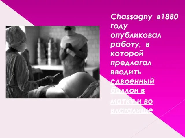 Chassagny в1880 году опубликовал работу, в которой предлагал вводить сдвоенный баллон в матку и во влагалище