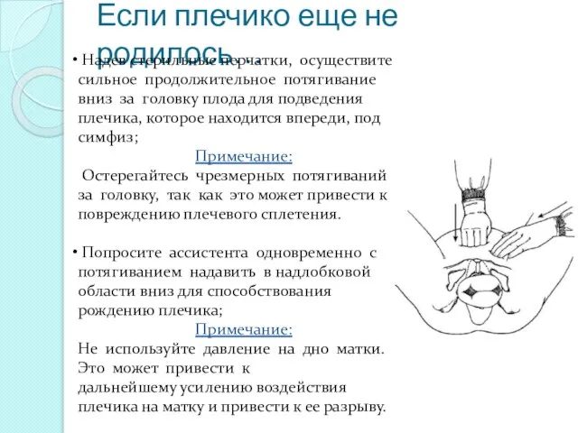 Если плечико еще не родилось… Надев стерильные перчатки, осуществите сильное продолжительное