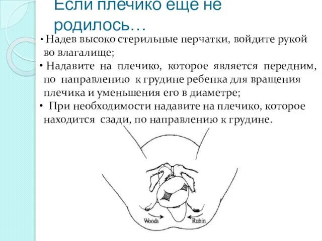 Если плечико еще не родилось… Надев высоко стерильные перчатки, войдите рукой