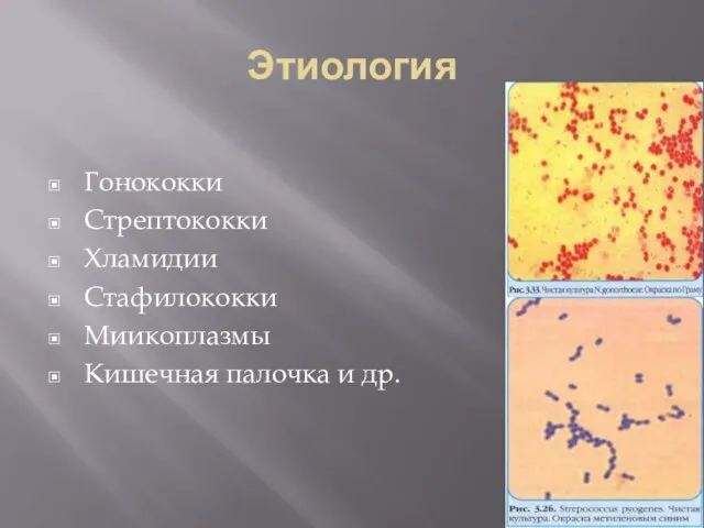 Этиология Гонококки Стрептококки Хламидии Стафилококки Миикоплазмы Кишечная палочка и др.