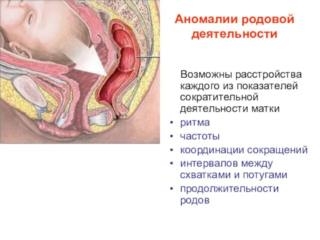 Аномалии родовой деятельности Возможны расстройства каждого из показателей сократительной деятельности матки