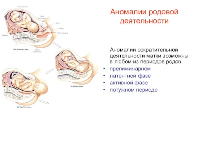 Аномалии родовой деятельности Аномалии сократительной деятельности матки возможны в любом из