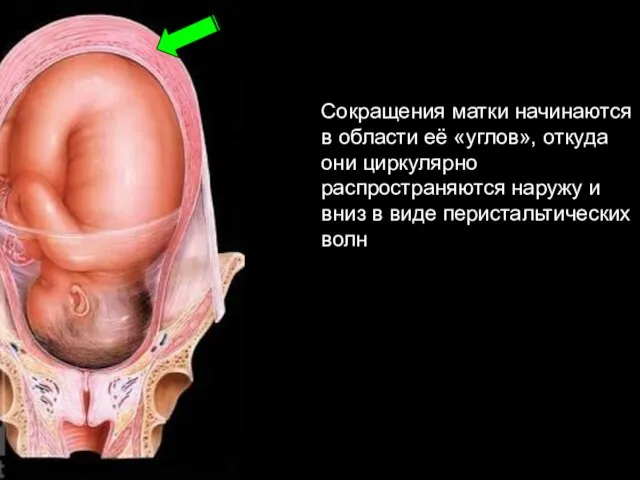 Сокращения матки начинаются в области её «углов», откуда они циркулярно распространяются