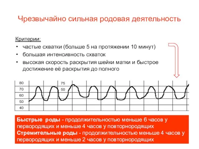 Чрезвычайно сильная родовая деятельность Критерии: частые схватки (больше 5 на протяжении