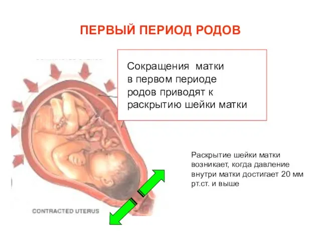 ПЕРВЫЙ ПЕРИОД РОДОВ Сокращения матки в первом периоде родов приводят к