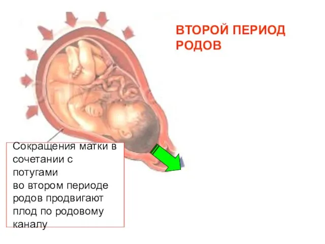 ВТОРОЙ ПЕРИОД РОДОВ Сокращения матки в сочетании с потугами во втором