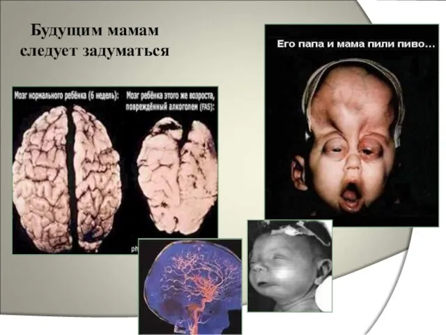 Будущим мамам следует задуматься