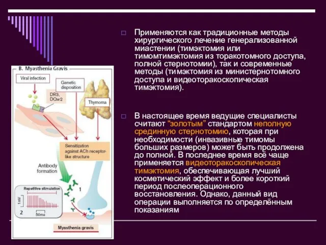 Применяются как традиционные методы хирургического лечение генерализованной миастении (тимэктомия или тимомтимэктомия