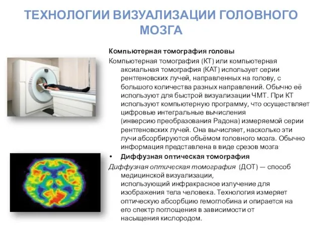 Технологии визуализации головного мозга Компьютерная томография головы Компьютерная томография (КТ) или