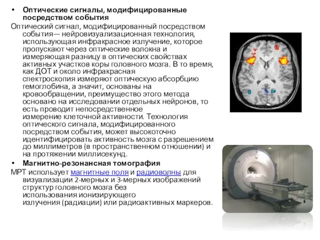 Оптические сигналы, модифицированные посредством события Оптический сигнал, модифицированный посредством события— нейровизуализационная