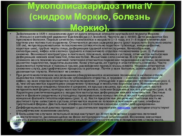 Мукополисахаридоз типа IV (снидром Моркио, болезнь Моркио). Заболевание в 1929 г.