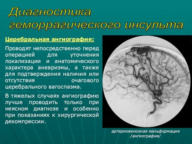 Диагностика геморрагического инсульта Церебральная ангиография: Проводят непосредственно перед операцией для уточнения