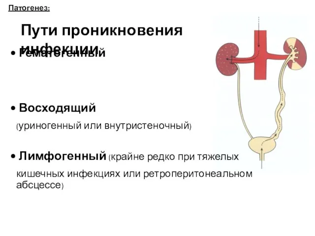 Патогенез: Пути проникновения инфекции Гематогенный Восходящий (уриногенный или внутристеночный) Лимфогенный (крайне