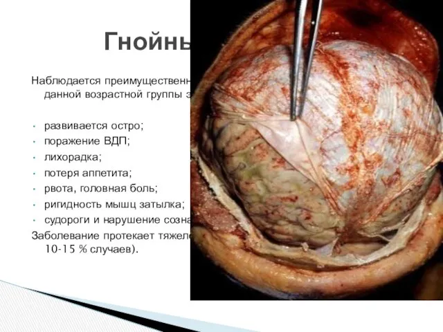 Наблюдается преимущественно у детей от 9 месяцев до 4 лет (для