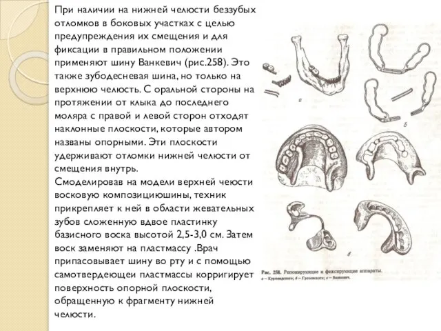 При наличии на нижней челюсти беззубых отломков в боковых участках с