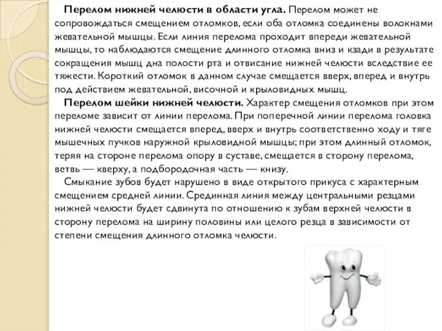 Перелом нижней челюсти в области угла. Перелом может не сопровождаться смещением